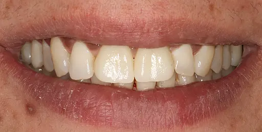 Sourire final